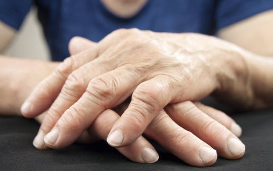 Psoriasis And Arthritis Can Increase Heart Attack and Stroke Risk